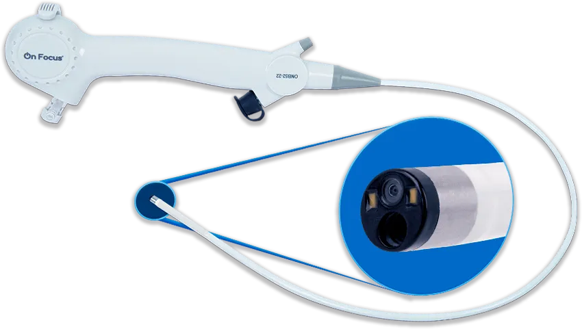 Broncoscopio con canal 5.2 mm